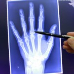 Handchirurgie Hannover