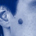 Haut- und Weichteilchirurgie